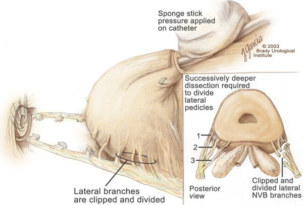 Finasteride propecia prezzo