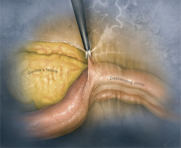 Levitra orosolubile generico